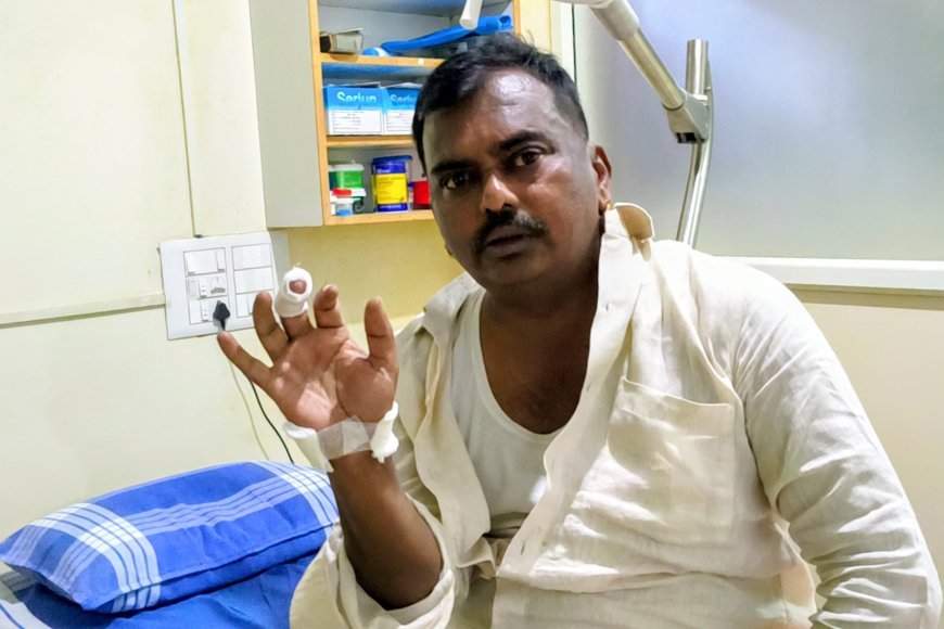 ಕುಶಾಲನಗರ: ಪುರಸಭೆ ಮಾಜಿ ಸದಸ್ಯ ದಿನೇಶ್ ಅವರ ಮೇಲೆ ಬೀದಿ ನಾಯಿ ದಾಳಿ