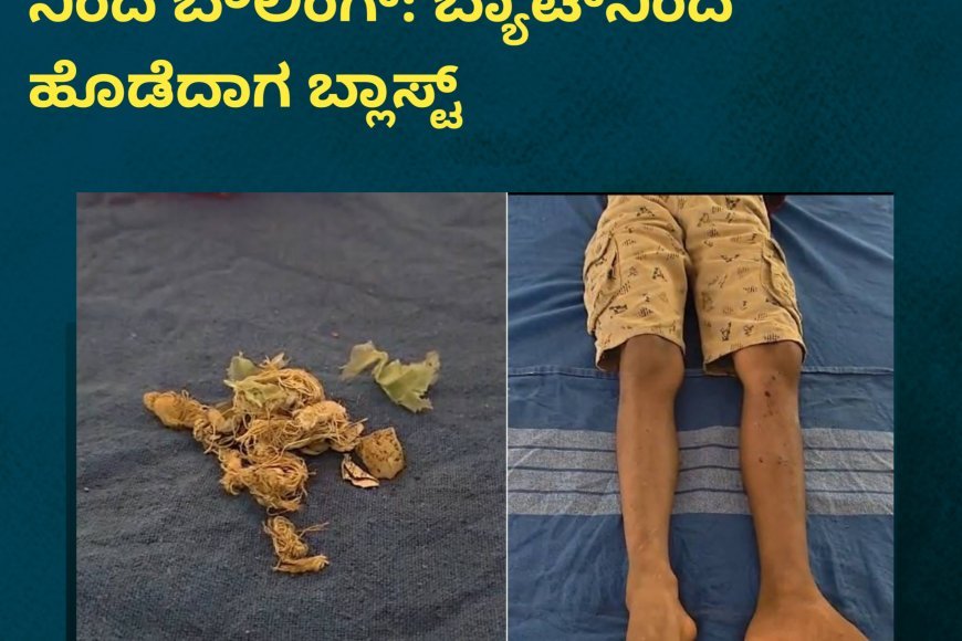 ಸ್ಪೋಟಗೊಂಡ ವಸ್ತು, ಬಾಲಕನ‌ ಕಾಲಿಗೆ ಗಾಯ
