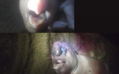 ಆನೆಯಲ್ಲ ಹಂದಿ.... ಸೊಂಡಿಲಿನೊಂದಿಗೆ ವಿಚಿತ್ರ ಆಕಾರದ ಹಂದಿಮರಿ ಜನನ