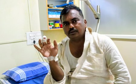 ಕುಶಾಲನಗರ: ಪುರಸಭೆ ಮಾಜಿ ಸದಸ್ಯ ದಿನೇಶ್ ಅವರ ಮೇಲೆ ಬೀದಿ ನಾಯಿ ದಾಳಿ