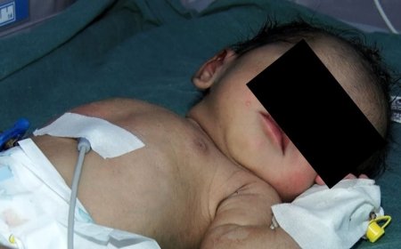 ದೇವಾಲಯದ ಬಳಿ ಅಮಾನವೀಯ ಕೃತ್ಯ; ಮುಳ್ಳಿನ ಪೊದೆಯಲ್ಲಿ ಪತ್ತೆಯಾದ ಒಂದು ದಿನದ ಹೆಣ್ಣು ಮಗು