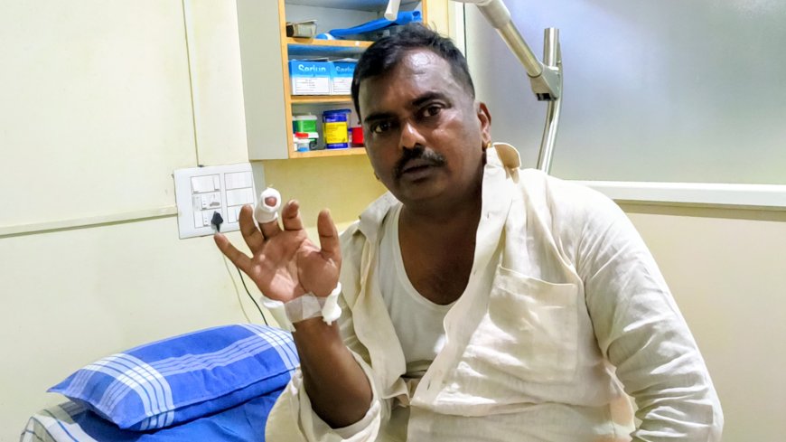 ಕುಶಾಲನಗರ: ಪುರಸಭೆ ಮಾಜಿ ಸದಸ್ಯ ದಿನೇಶ್ ಅವರ ಮೇಲೆ ಬೀದಿ ನಾಯಿ ದಾಳಿ