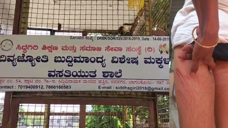 ಬುದ್ಧಿಮಾಂದ್ಯ ಬಾಲಕನ ಮೇಲೆ ಶಿಕ್ಷಕ ದಂಪತಿಯಿಂದ ಕಣ್ಣಿಗೆ ಖಾರದಪುಡಿ ಎರಚಿ ಹಲ್ಲೆ ಆರೋಪ