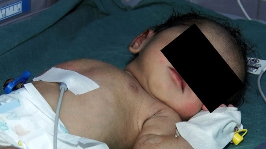 ದೇವಾಲಯದ ಬಳಿ ಅಮಾನವೀಯ ಕೃತ್ಯ; ಮುಳ್ಳಿನ ಪೊದೆಯಲ್ಲಿ ಪತ್ತೆಯಾದ ಒಂದು ದಿನದ ಹೆಣ್ಣು ಮಗು