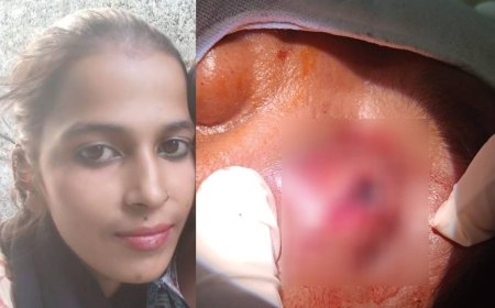 ಕೈ ಮುರಿದು, ಕಣ್ಣಿಗೆ ಚಾಕು ಇರಿತ: ಪತ್ನಿಯಿಂದ ಹಲ್ಲೆಗೊಳಗಾದ ರೌಡಿಶೀಟರ್! 