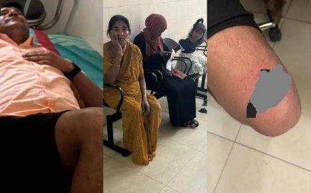 ಕುಶಾಲನಗರ;ಬಾಲಕಿ ಸೇರಿ‌ ಹಲವು  ಮಂದಿಯ ಮೇಲೆ ಬೀದಿ ನಾಯಿ ದಾಳಿ