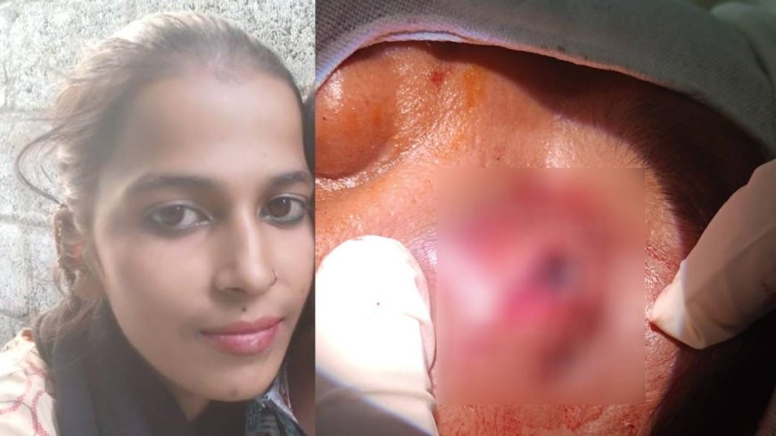 ಕೈ ಮುರಿದು, ಕಣ್ಣಿಗೆ ಚಾಕು ಇರಿತ: ಪತ್ನಿಯಿಂದ ಹಲ್ಲೆಗೊಳಗಾದ ರೌಡಿಶೀಟರ್! 