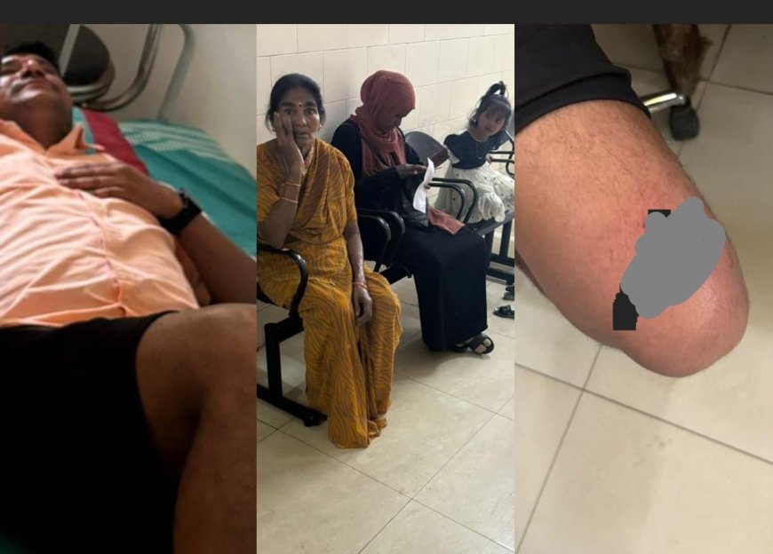 ಕುಶಾಲನಗರ;ಬಾಲಕಿ ಸೇರಿ‌ ಹಲವು  ಮಂದಿಯ ಮೇಲೆ ಬೀದಿ ನಾಯಿ ದಾಳಿ