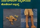 ಮಂಗಳೂರು: ಬಾಲ್ ಎಂದು ಬಾಂಬ್​​​​​ನಿಂದ ಬೌಲಿಂಗ್: ಬ್ಯಾಟ್​ನಿಂದ ಹೊಡೆದಾಗ ಬ್ಲಾಸ್ಟ್