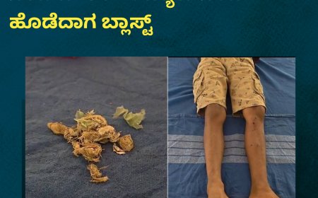 ಮಂಗಳೂರು: ಬಾಲ್ ಎಂದು ಬಾಂಬ್​​​​​ನಿಂದ ಬೌಲಿಂಗ್: ಬ್ಯಾಟ್​ನಿಂದ ಹೊಡೆದಾಗ ಬ್ಲಾಸ್ಟ್