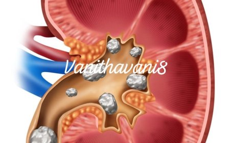 ಮೂತ್ರಕೋಶದಲ್ಲಿ ಕಲ್ಲಿನ ಸಮಸ್ಯೆಯೇ!