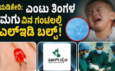 ಮಡಿಕೇರಿ:ಎಂಟು ತಿಂಗಳ ಮಗುವಿನ ಗಂಟಲಲ್ಲಿ ಎಲ್‌ಇಡಿ ಬಲ್ಬ್! ವೈದ್ಯರು ಮಾಡಿದ್ದೇನು ಗೊತ್ತಾ?