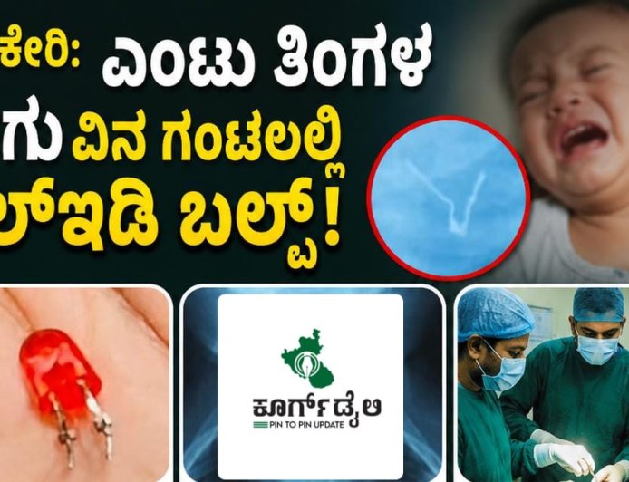 ಮಡಿಕೇರಿ:ಎಂಟು ತಿಂಗಳ ಮಗುವಿನ ಗಂಟಲಲ್ಲಿ ಎಲ್‌ಇಡಿ ಬಲ್ಬ್! ವೈದ್ಯರು ಮಾಡಿದ್ದೇನು ಗೊತ್ತಾ?