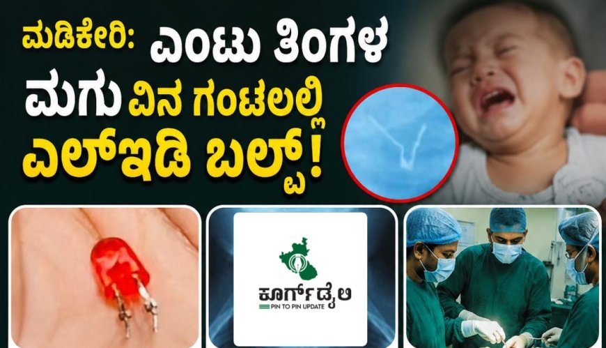 ಮಡಿಕೇರಿ:ಎಂಟು ತಿಂಗಳ ಮಗುವಿನ ಗಂಟಲಲ್ಲಿ ಎಲ್‌ಇಡಿ ಬಲ್ಬ್! ವೈದ್ಯರು ಮಾಡಿದ್ದೇನು ಗೊತ್ತಾ?